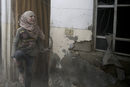 Ранено момиче след въздушен удар в квартал Дума, Дамаск, Сирия.