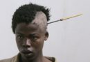 Момче със забита в главата стрела очаква медицинска помощ в болница, където е докаран след сблъсък на етническа основа между племена в долината Рифт в Кения (януари 2008 г.).