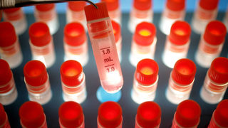 Израел разработва лечение на болестта на Лу Гериг с присаждане на стволови клетки