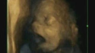 Снимки с 4D ултразвук показаха бебешки прозявки в утробата