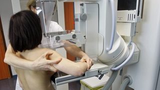 Смъртните случаи от рак на гърдата в Европа ще се удвоят до 2030 г., прогнозират учени