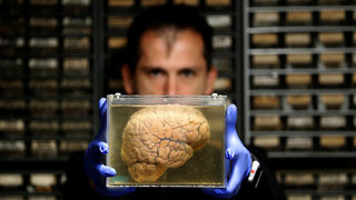 Фотогалерия: "Склад за мозъци" може да помогне на медицината