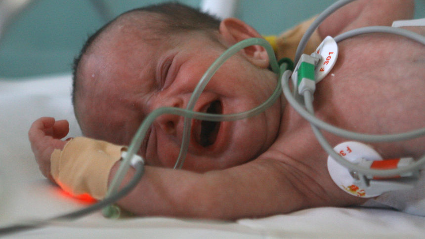 Учени установиха, че предизвиканото раждане намалява перинаталната смъртност