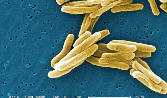 Всяка година по света се откриват около половин милион случая на туберкулоза, резистентна на всякакви антибиотици.