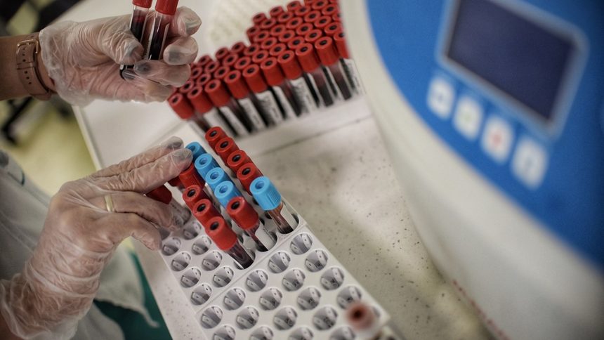Здравното министерство предлага тестовете за антитела да се плащат от касата